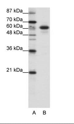 CBLL1 / HAKAI Antibody (C-Terminus)