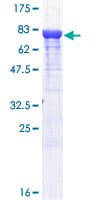 Human PKM / Pyruvate Kinase, Muscle Protein (Recombinant GST)