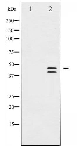 ERK1 + ERK2 Antibody (phospho-Thr202)