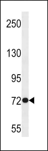 SOWAHB / ANKRD56 Antibody (aa412-438)