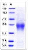 Mouse CD28 Protein (Recombinant His,C-terminus)