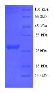 Rabbit IL6 / Interleukin 6 Protein (Recombinant 6His, N-terminus)