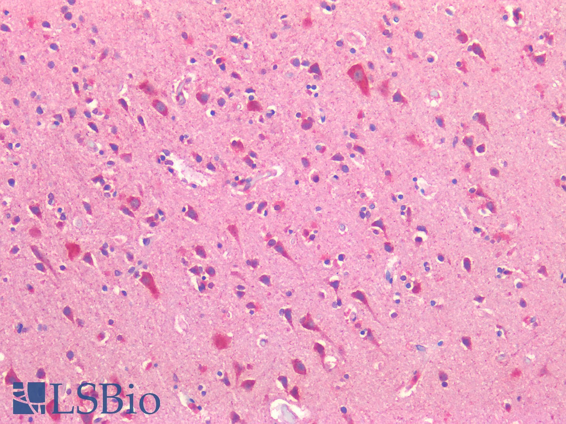 IHC-plus™ ROR1 Antibody (Internal Region)
