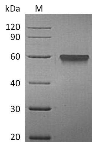 Human TNFRSF9 / 4-1BB / CD137 Protein (Recombinant Fc, C-terminus)