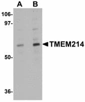 TMEM214 / FLJ20254 Antibody