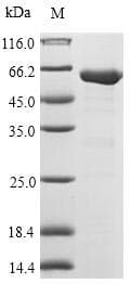 Escherichia coli fabB Protein (Recombinant 6His-SUMO, N-terminus + Myc, C-terminus)