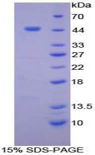 Chicken BAFF Receptor / CD268 Protein (Recombinant His-GST)