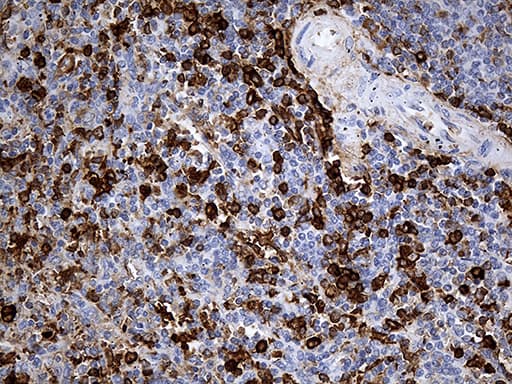 JUP/CTNNG/Junction Plakoglobin Antibody (aa500-745, clone OTI4D5)