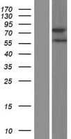ZMAT1 Protein (Over-Expression Lysate Myc-DDK (Flag))