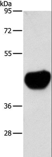 ACTA2 / Smooth Muscle Actin Antibody