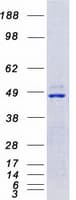 Human CAMK4 / CaMK IV Protein (Recombinant Myc-DDK (Flag))