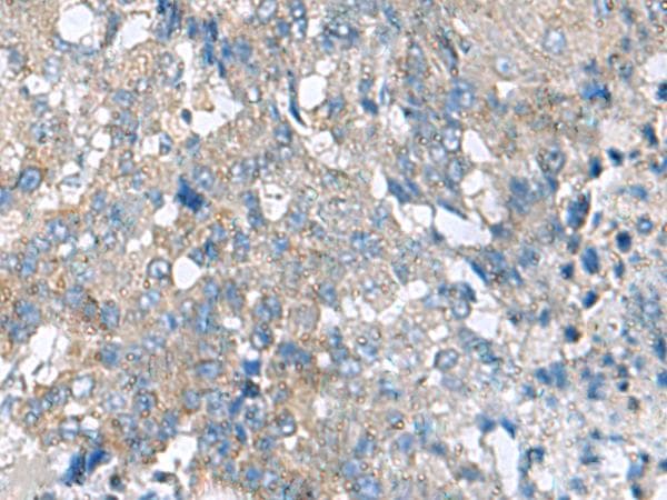 Polyclonal Rabbit anti-Human HPCAL1 / Hippocalcin-Like 1 Antibody (IHC, WB)