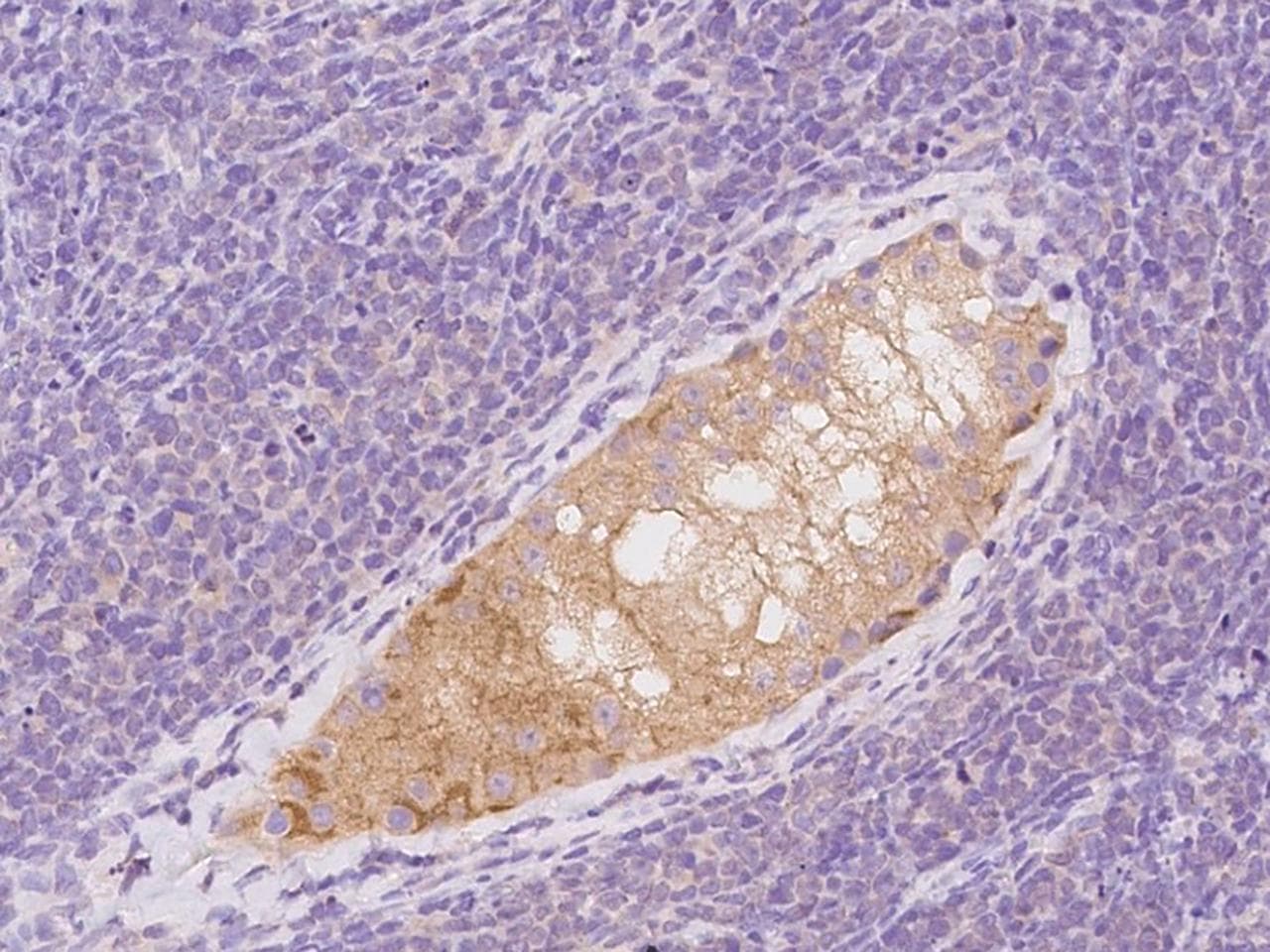 MAPRE1 / EB1 Antibody