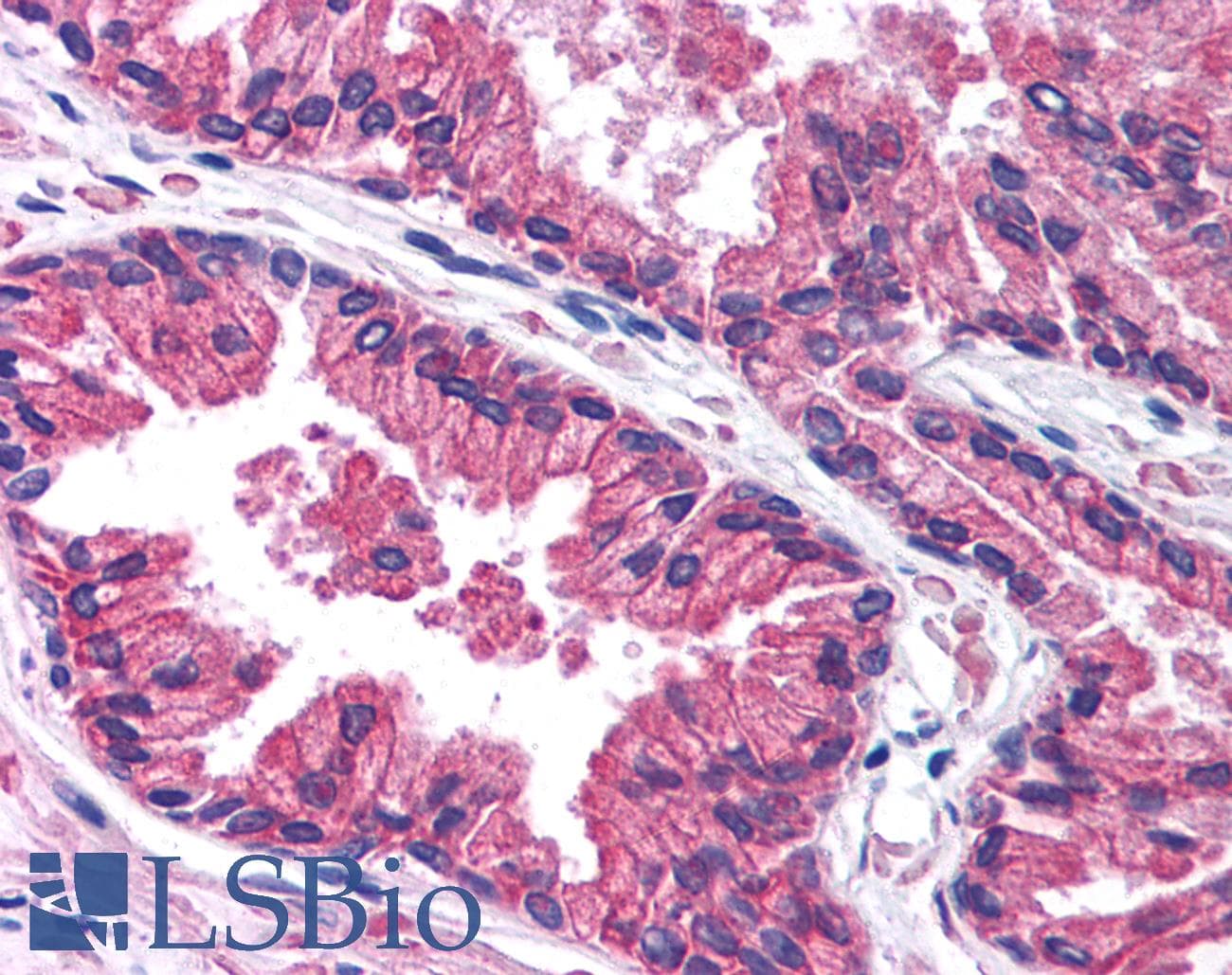 KCNN3 / SK3 Antibody (aa642-691)