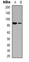 Polyclonal Rabbit anti-Human ITGB3 / Integrin Beta 3 / CD61 Antibody (C-Terminus, WB)