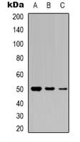 Polyclonal Rabbit anti-Human CCKBR / Cckb Antibody (WB)