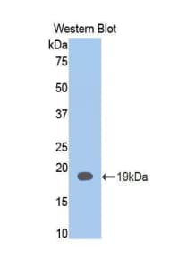 Mucin 2 / MUC2 Antibody (aa1294-1442)