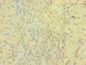 Polyclonal Rabbit anti-Human TIMP1 Antibody (IHC, WB)