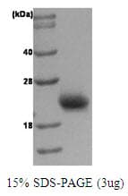 Human RAC1 Protein (Recombinant)
