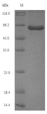 Porphyromonas gingivalis Peptidylarginine Deiminase Protein (Recombinant 6His, N-terminus)