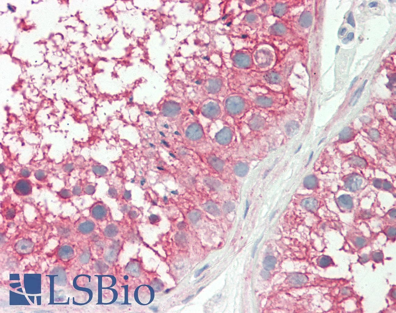 IHC-plus™ Monoclonal Rat anti-Yeast Alpha Tubulin Antibody (clone YOL1/34, IHC, WB)
