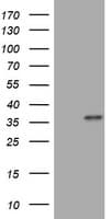 MUC16 / CA125 Antibody (aa13200-13700, clone OTI2F1C9)