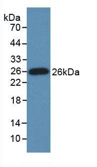 GRIP1 Antibody (Cy3)