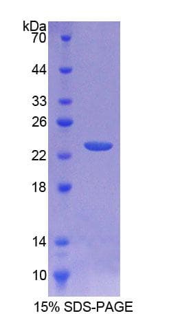 Rat CD40 Protein (Recombinant His-T7)