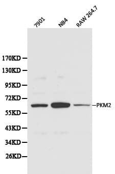 PKM / Pyruvate Kinase, Muscle Antibody