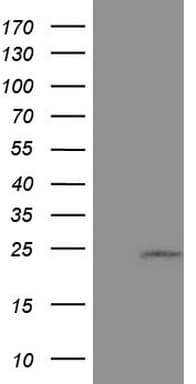CSF3 / G-CSF Antibody (aa30-207, clone OTI1G8)