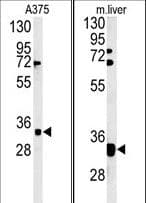 FYTTD1 Antibody (aa26-54)