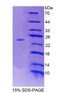 Mouse ADCY7 / Adenylate Cyclase 7 Protein (Recombinant His-T7)
