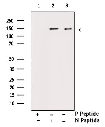 PDGFRA / PDGFR Alpha Antibody (phospho-Tyr849)