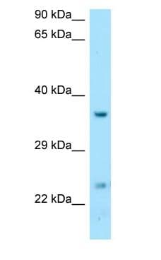 DTD1 Antibody (aa137-186)