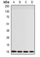 RPS14 / Ribosomal Protein S14 Antibody
