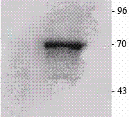 RPS6KB1 / P70S6K / S6K Antibody (C-Terminus)