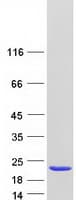 Human FHIT Protein (Recombinant Myc-DDK (Flag))