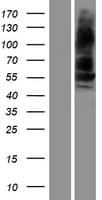 ALK-6 / BMPR1B Protein (Over-Expression Lysate Myc-DDK (Flag))