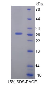 Rat SLAMF1 / SLAM / CD150 Protein (Recombinant His-T7)