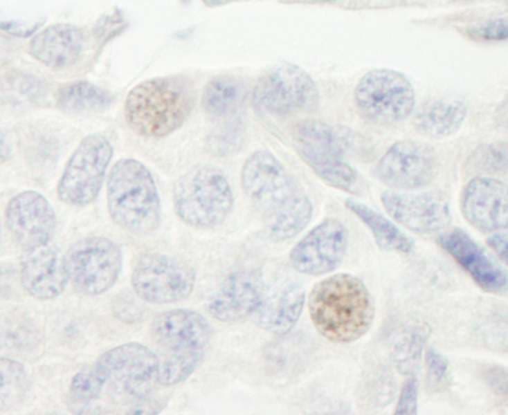GTF3C2 Antibody (aa75-125)