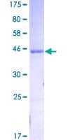 Human GCG / Glucagon Protein (Recombinant GST)