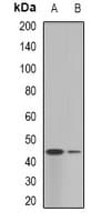GALT Antibody