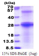 Hepatitis C Virus HCV E2 Protein (Recombinant His)