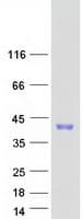 Human MSX2 / MSH Protein (Recombinant Myc-DDK (Flag))