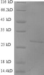 Human DKK1 Protein (Recombinant 6His, N-terminus)
