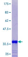Human MT2A / Metallothionein 2A Protein (Recombinant GST)