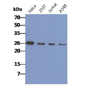 Monoclonal Mouse anti-Human CACYBP Antibody (clone AT3G8, WB)