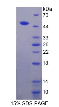 Bovine Aspartate Aminotransferase Protein (Recombinant His-T7)