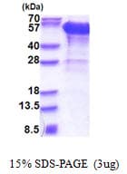 Human Dynactin 2 / Dynamitin Protein (Recombinant His)