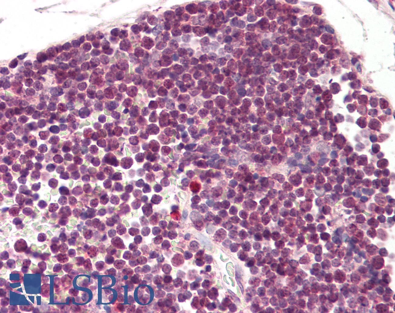 IHC-plus™ RAN Antibody (aa2-14)